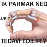 Tətik Barmaq nədir?