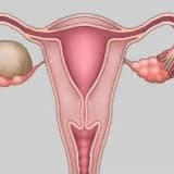 Qadın cinsiyyət orqanlarının iltihabı xəstəlikləri