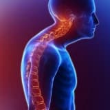 Kifoz: simptomlar, səbəblər və müalicə