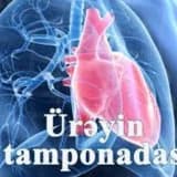 Üreyin tamponadasi