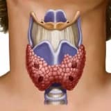 ZOB XƏSTƏLİYİ / ZOB XƏSTƏLİYİNİN ƏLAMƏTLƏRİ / DÜYÜNLÜ UR / QALXANVARİ VƏZİ XƏSTƏLİKLƏRİ