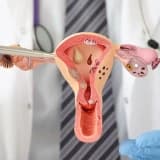Endometrit