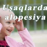 Usaqlarda alopesiya