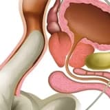 Prostatit
