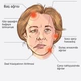 İflic Simptomları, Risk Faktorları, Diaqnozu və Müalicəsi