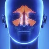 Sinus- Ağrı, Axıntı, Təzyiq