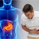 Qapalı Mədə Xərçəngi Əməliyyatları