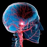 Üzün sümük və yumşaq toxumalarının travmaları