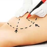 Döş Estetikası: Mammoplasti