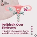 Polikistik Over Sindromu Müalicə Olunmazsa Hansı Xəstəliklərə Yol Açabilər?
