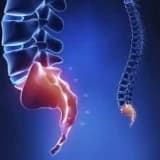 Anobuzdum ağri sindromu koksiqodiniya