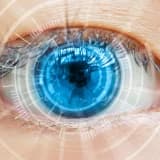 LASIK əməliyyatından əvvəl bilməli olduğunuz 20 şey