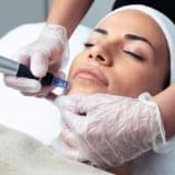 Dermapen tətbiqi