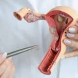 Qadın cinsi orqanında qaşınma - Vaginal qaşınma