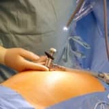 Laparoskopik və histereskopik əməliyyatlar