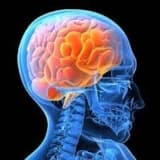 İnsult, dağınıq skleroz və Parkinson xəstəliyi də daxil olmaqla nevroloji pozğunluqlar