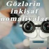 Gozlerin inkisaf anomaliyalari