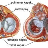 Ürək Qapak Problemləri: Anatomik Tənzimləmələrin Mübarizəsi