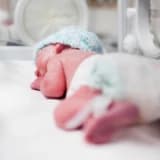 Vaxtından əvvəl doğulmuş uşaqların ROP müayinəsi və müalicəsi