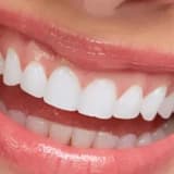 İmplant müalicəsi nədir?