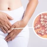 Genital nahiye qaralmasinin sebebleri