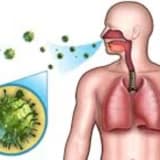 aşağı tənəffüs yollarının infeksiyaları