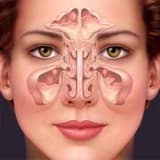 Endoskopik Sinus Cərrahiyyəsi Haqqında Məlumat