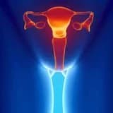 Uşaqlıq boynunun eroziyası