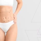 İstenmeyen yağdan qurtulun: liposaksiya ilə arıqlayın liposaksiya proseduru və qiymətləri