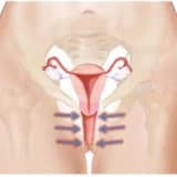 Vaginizm - Qadınlarda Cinsi Əlaqə Qorxusu