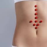 Aybaşı pozulması (menstrual siklus pozğunluğu)