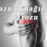 Bazu oynaginin artrozu