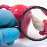 Endometrioz