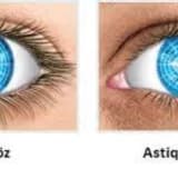 Astiqmatizm