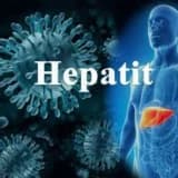 Hepatit müayinəsi