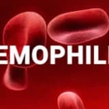 Hemofiliya
