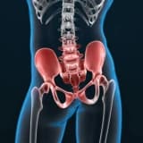 Omba sınığı əməliyyatı (Bud-çanaq əməliyyatı)