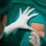 Qeysəriyyə əməliyyatı (epidural, spinal, gen anesteziyası)