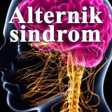 Alternik sindrom