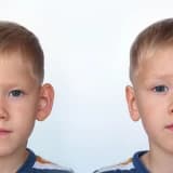 Qulaq Estetikası və Görkəmli Qulaq Problemi