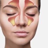 Endoskopik Sinus Cərrahiyyəsi