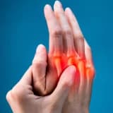 Romatoid artrit: simptomlar, müalicə və məna