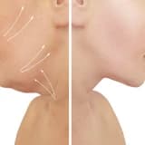 Boyun və Üz Liftinqi