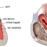 Mitral Qapaq Xəstəliyi: Ürəyin Kritik Komponentlərindən Birində Problemlər