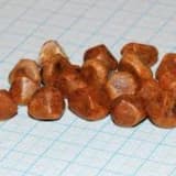 Öd kisəsində və ya öd yollarında daşların yaranması