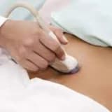 Ginekoloji (vaginal ultrasəs)