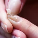 Kövrək Dırnaqlar: Problemlərin Əsasında Yatan Səbəblər və Baxım Tövsiyələri