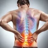 Bel Ağrısı, Risk Faktorları və Müalicə Prosesi Haqqında