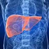 Qaraciyər Transplantasiyası: Proses, Səbəblər və Nəticələr