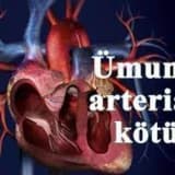 Ümumi arterial kotuk
